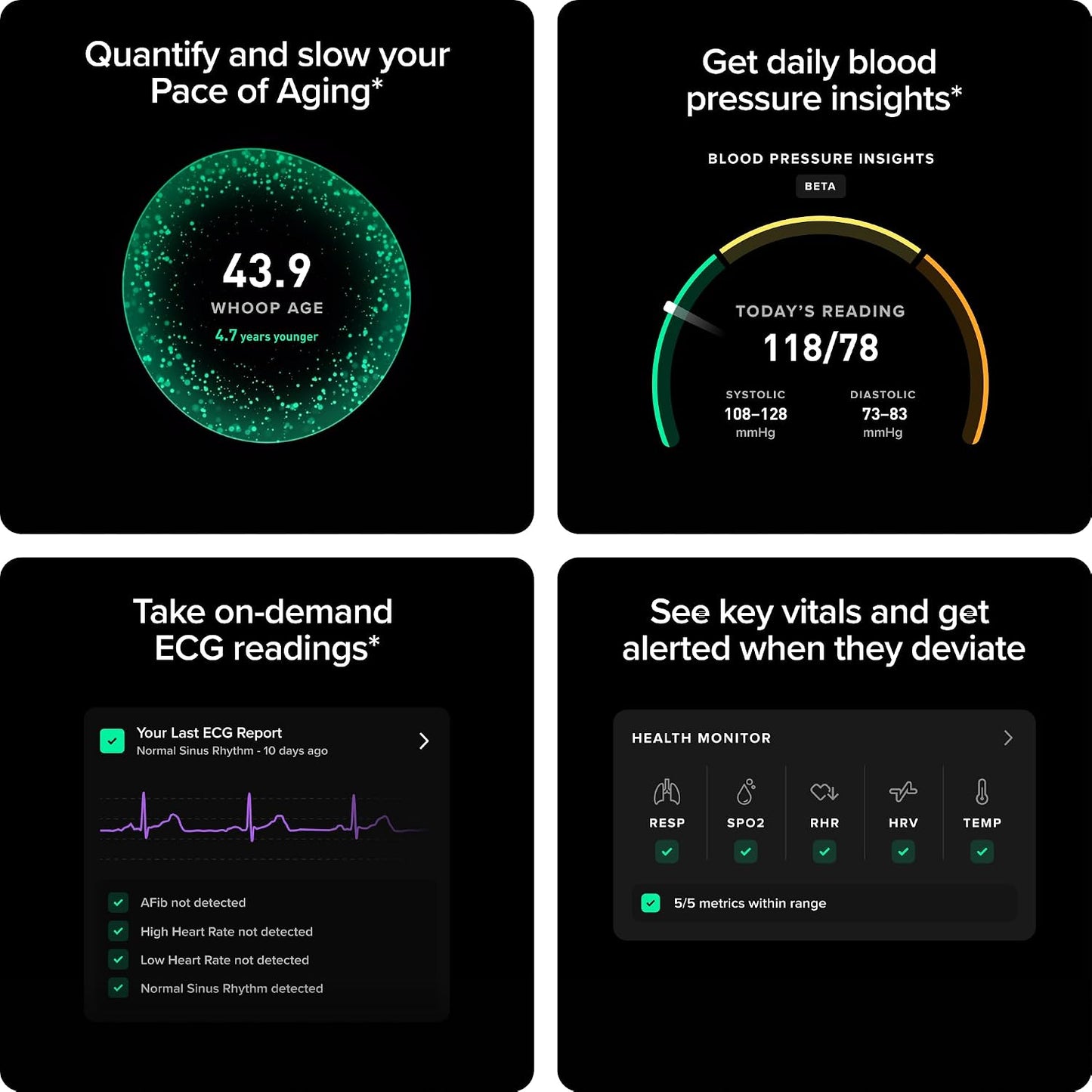 WHOOP Life 5.0/MG Activity Tracker - 12 Month Membership
